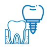 Implantes dentales