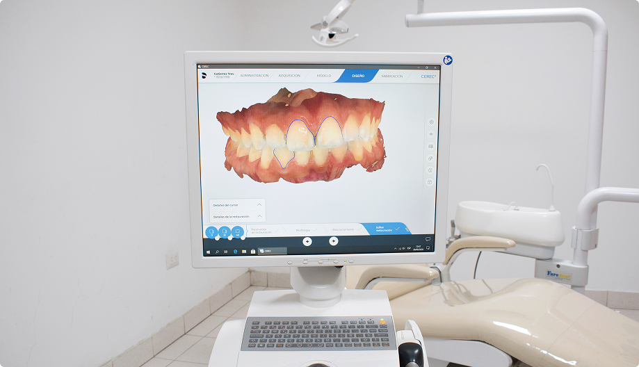 ¿Te falta un diente? Por qué los implantes son la mejor solución para recuperar tu sonrisa y tu salud